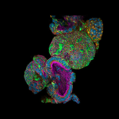 Organoids on drugs