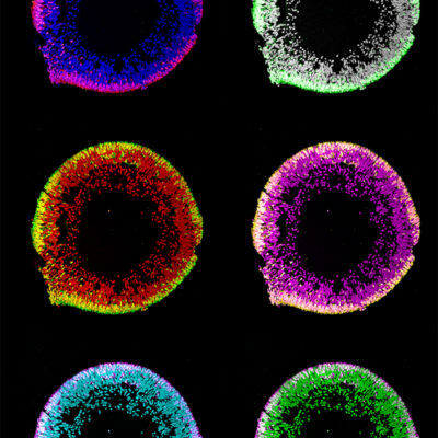 Andy Warhol's retinal organoids
