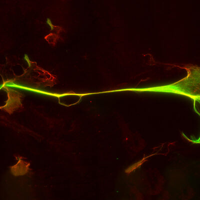 Glowing astrocyte