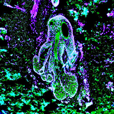 Octopus epidermalis