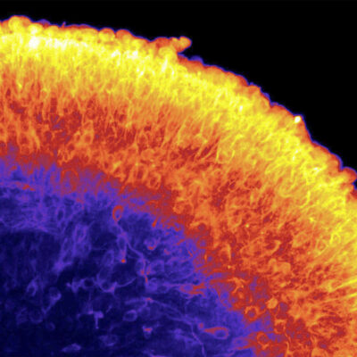 Retinal Rainbow