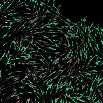 Neuronal myriad