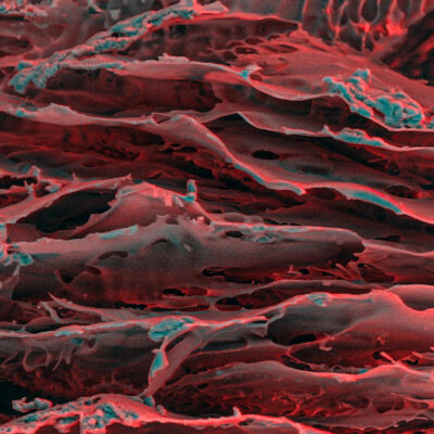 Mil Hojas de Hydrogel