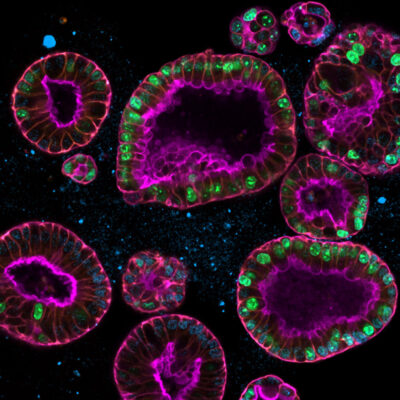 Bloom of cells